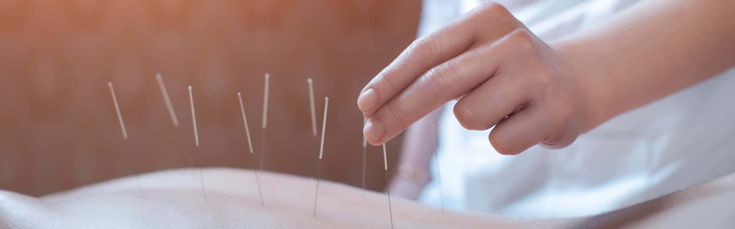 Barry's Bay Acupuncture